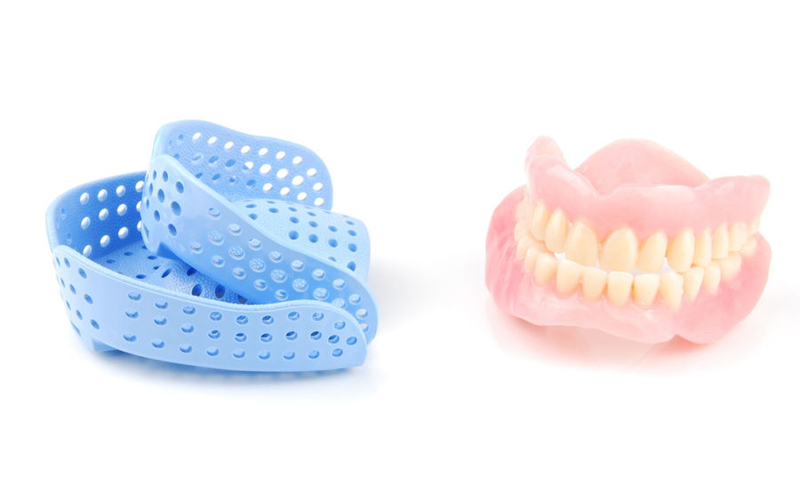 Nos services de restauration sur implants